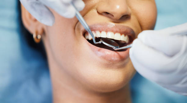 Best Emergency Tooth Extraction in Lukachukai, AZ