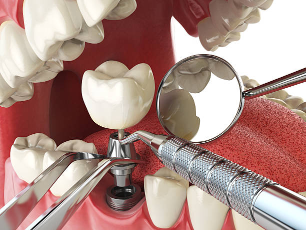 Best Cosmetic Emergency Dentistry in Lukachukai, AZ
